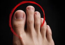 Ai al doilea deget de la picior mai lung? Ce înseamnă acest detaliu și când poate provoca probleme