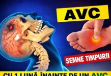Semnele de alarmă ale unui AVC: simptomele care nu trebuie ignorate, chiar dacă dispar după câteva minute